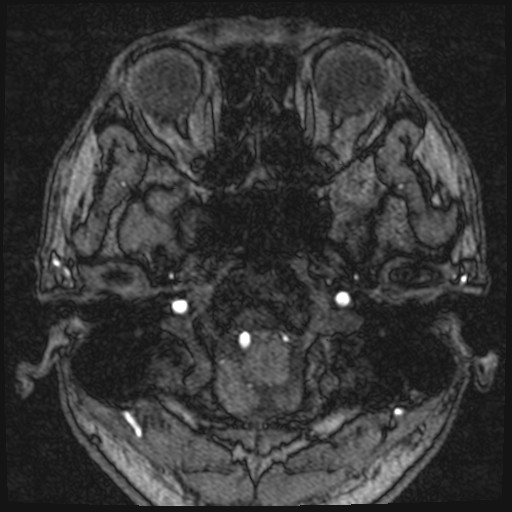 Click on the Serie image to view the images of VILLANUEVA, WILLIAM A.